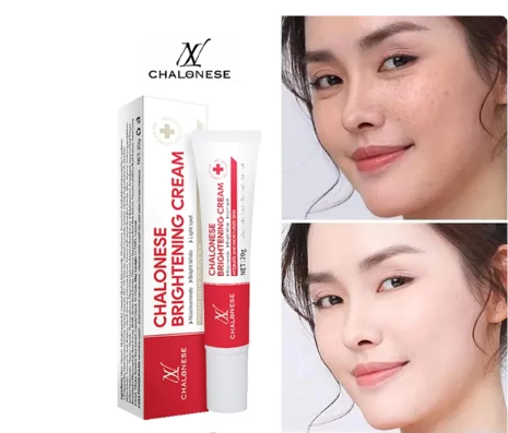 Buy 1 Get 1 Free - Chalonese Brightening Cream