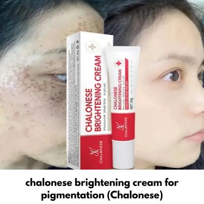 Chalonese Brightening Cream | (Both for Men & Women)