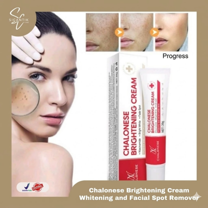 Chalonese Brightening Cream | (Both for Men & Women)